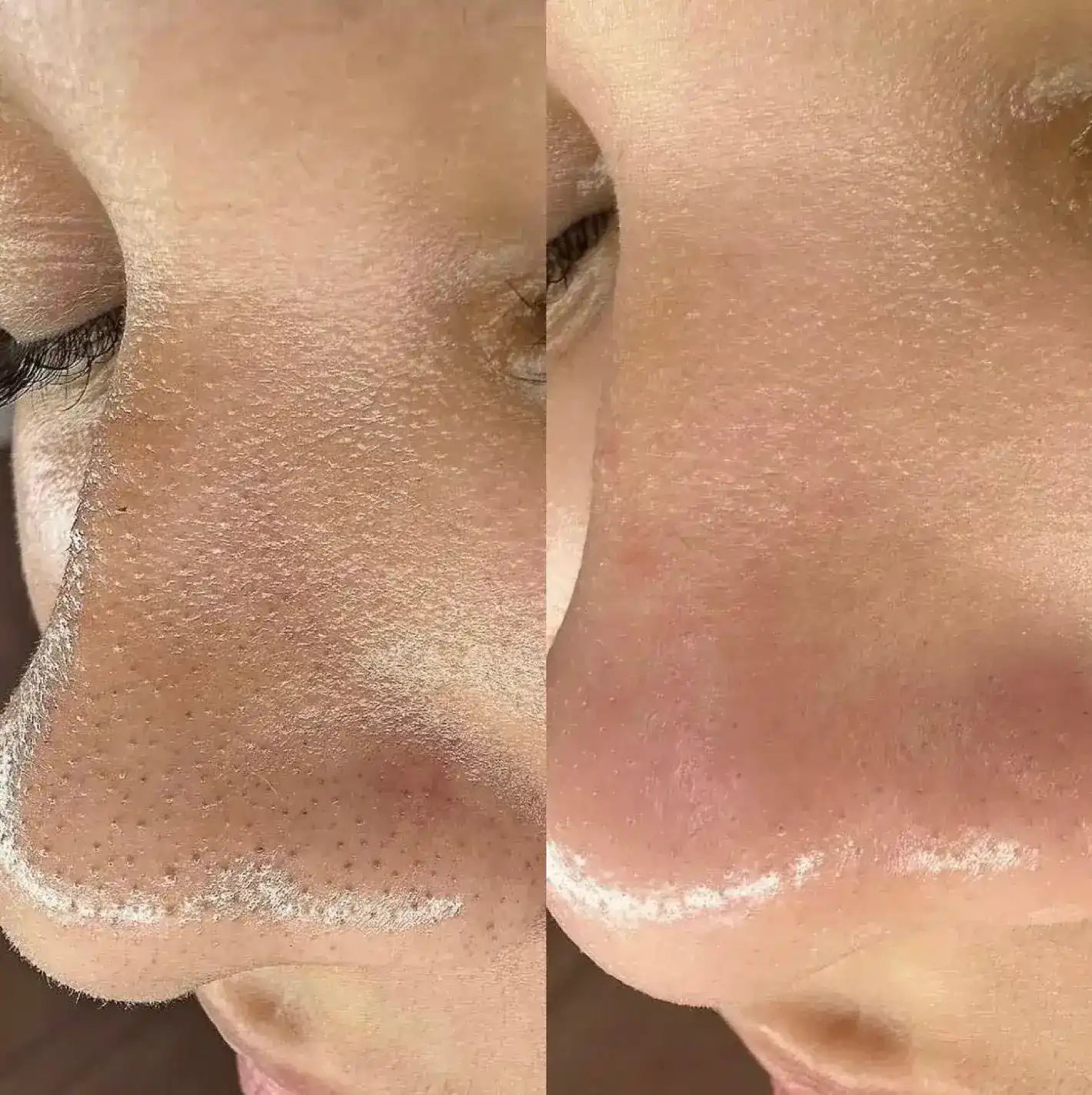 Dr Melaxin™ (x2 uds) – Exfolia, Hidrata. Suavidad que se siente ✨💧