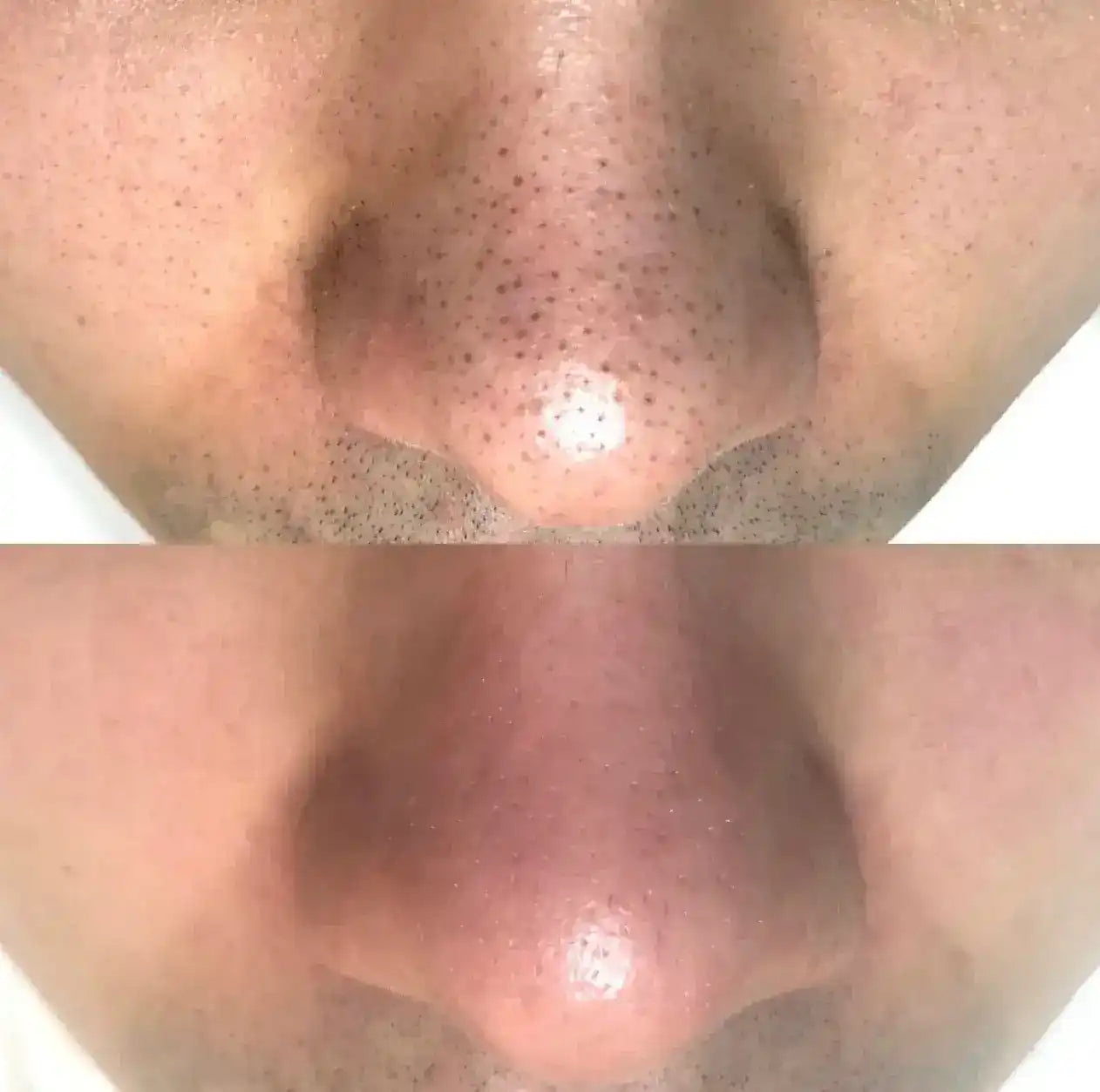 Dr Melaxin™ (x2 uds) – Exfolia, Hidrata. Suavidad que se siente ✨💧